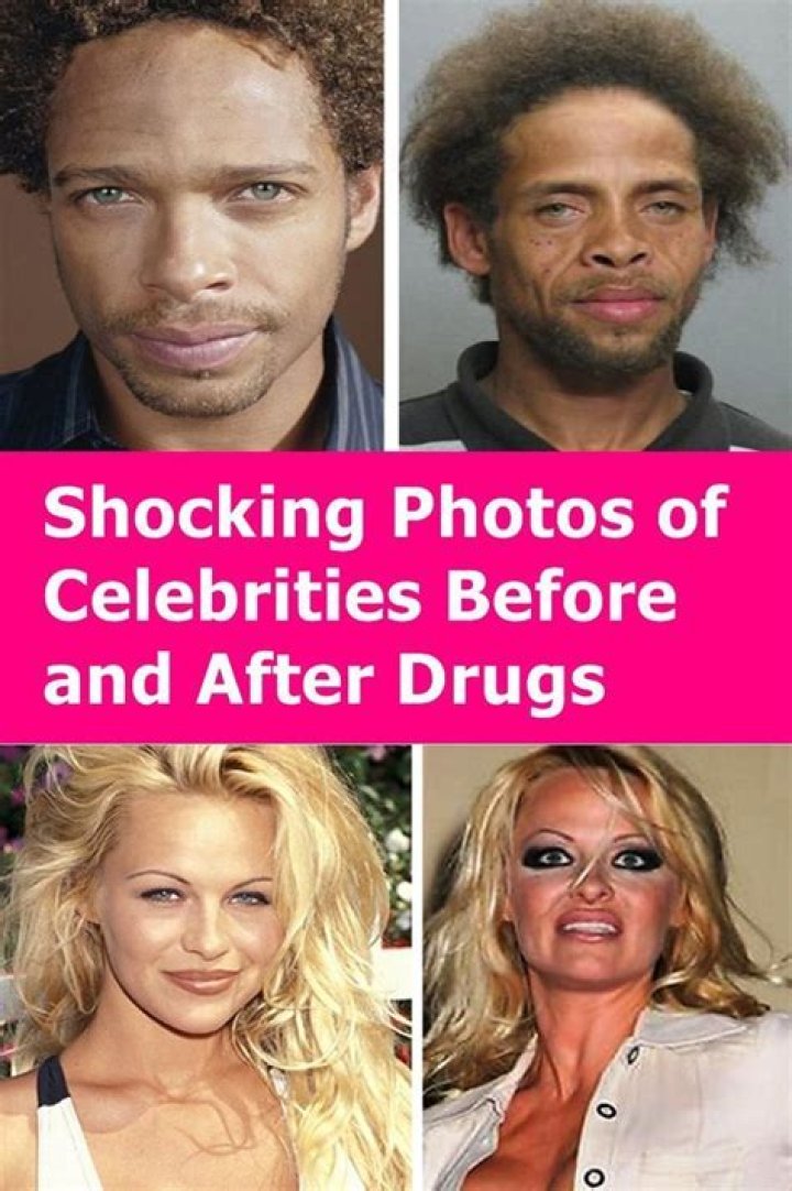 10 shocking before and after pics of celebrities ravaged by drink and drugs – The Sun