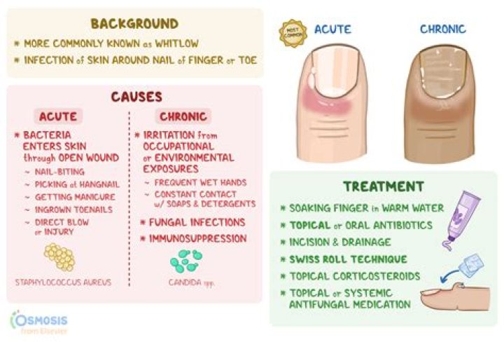 14 Best Cuticle Creams to Pamper And Nourish Damaged Nails