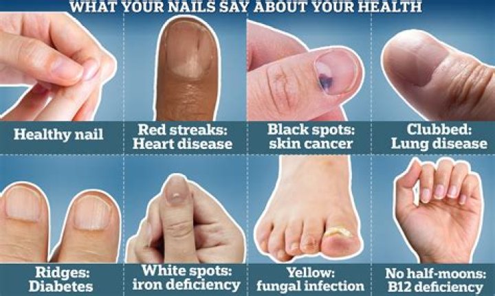 15 Best Cuticle Nippers to Improve Overall Nail Health And Appearance