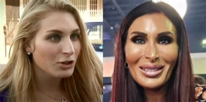 Age, Height, Net Worth, Plastic Surgery
