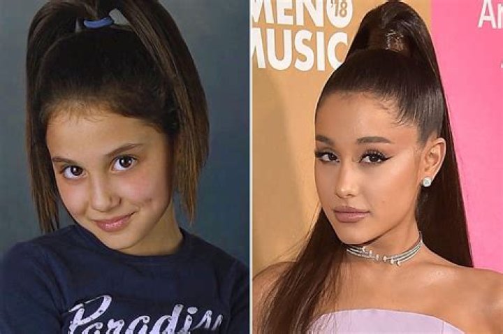 Ariana Grande Chirurgie : Les éventuelles interventions esthétiques de la chanteuse
