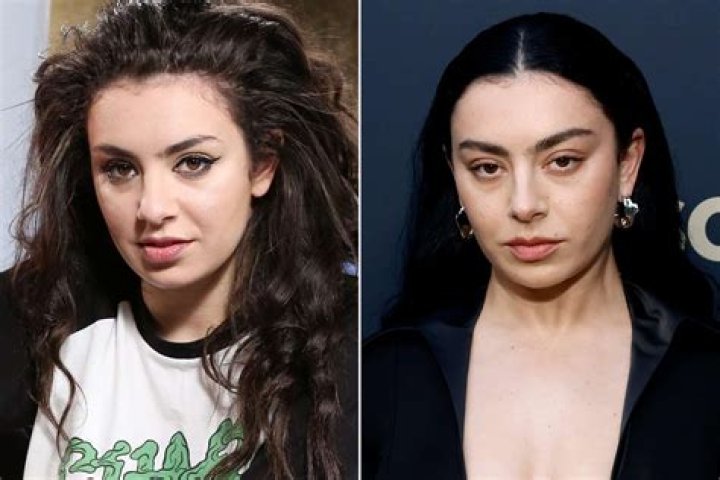 Ariana Grande’s Facial Transformation Sparks Plastic Surgery Speculation: Uncovering the Truth