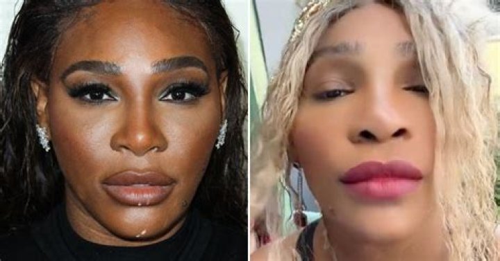 Azealia Banks Admits to Bleaching Her Skin, Says She Did It to Assimilate
