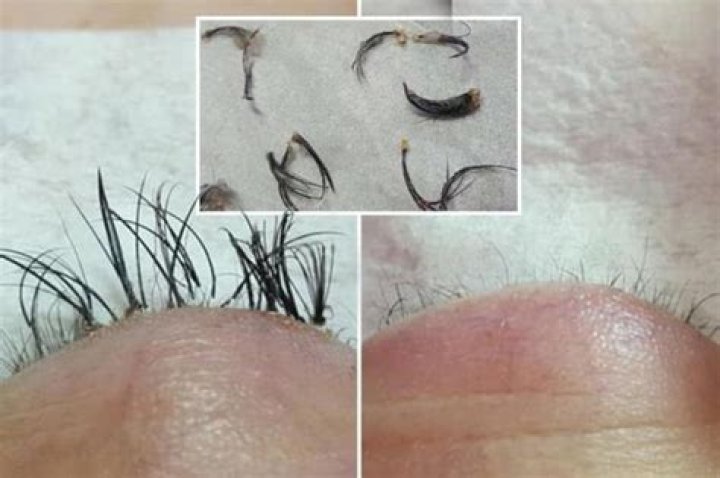 Beautician shares stomach-churning pics of botched eyelash extensions as a warning to others