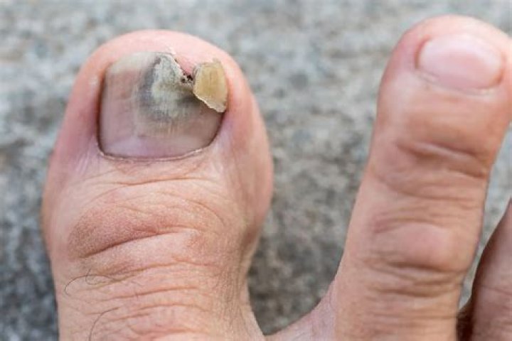 Big Ed turns to ‘internet doctors’ for help but gets trolled over his toenails