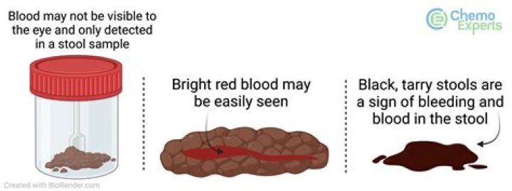 Blood In Your Poop? Don't Panic, Here's What To Do