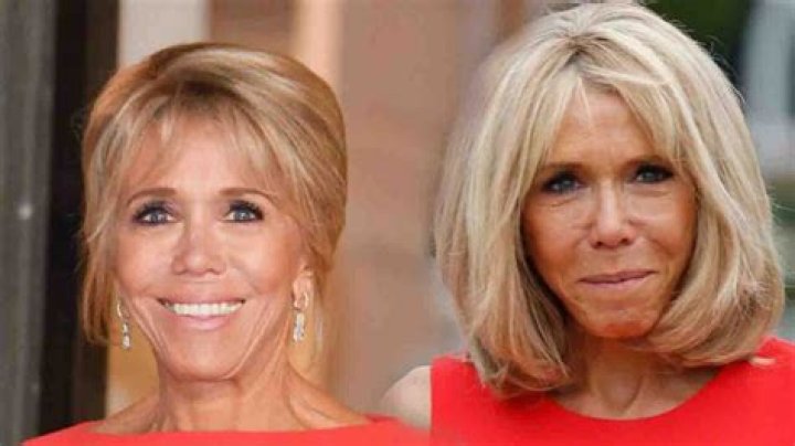 Brigitte macron chirurgie