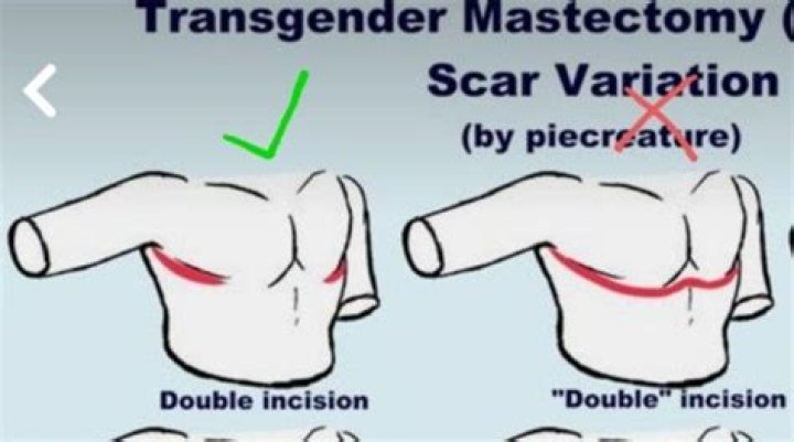 Costa uses cartoon image of 'trans man' with mastectomy scars in advert as angry customers threaten boycott