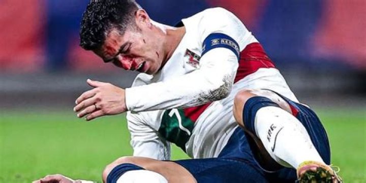 Cristiano Ronaldo - Injury history