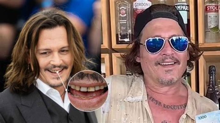 Decoding Johnny Depp's Plastic Surgery Debate