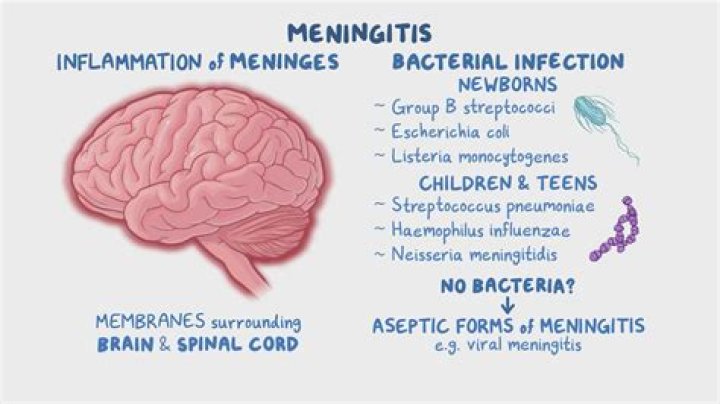 Did Jeff Beck Die of Bacterial Meningitis Disease?