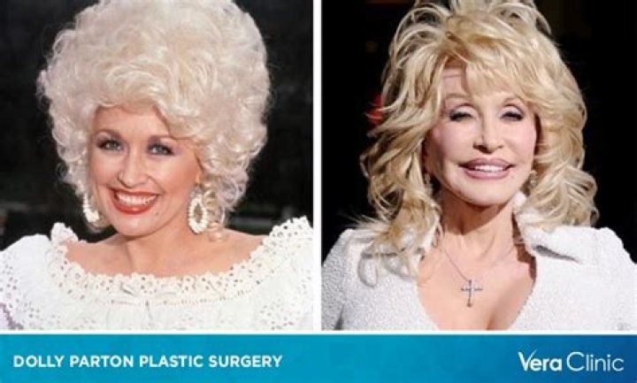 Does Dolly Parton have breast implants and did she get them insured?