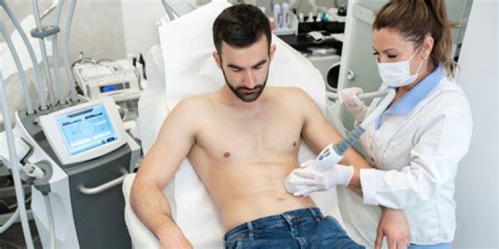 Everything You Need to Know About Abdominal Etching