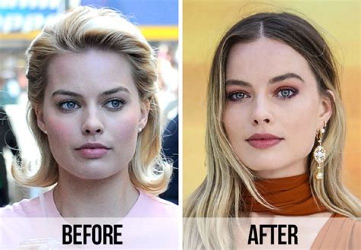 Fans Spot A ‘Huge Difference’ In Margot Robbie’s Appearance After Looking At Before And After Photos