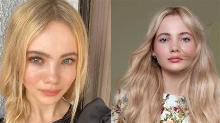 Freya Allan Chirurgie