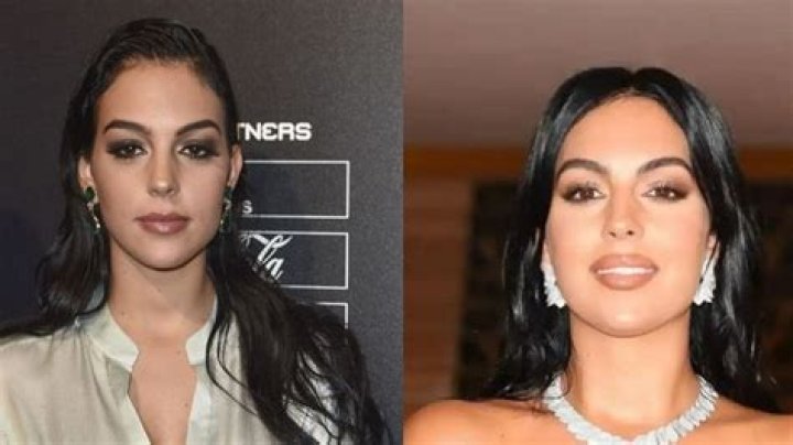 georgina rodriguez chirurgie