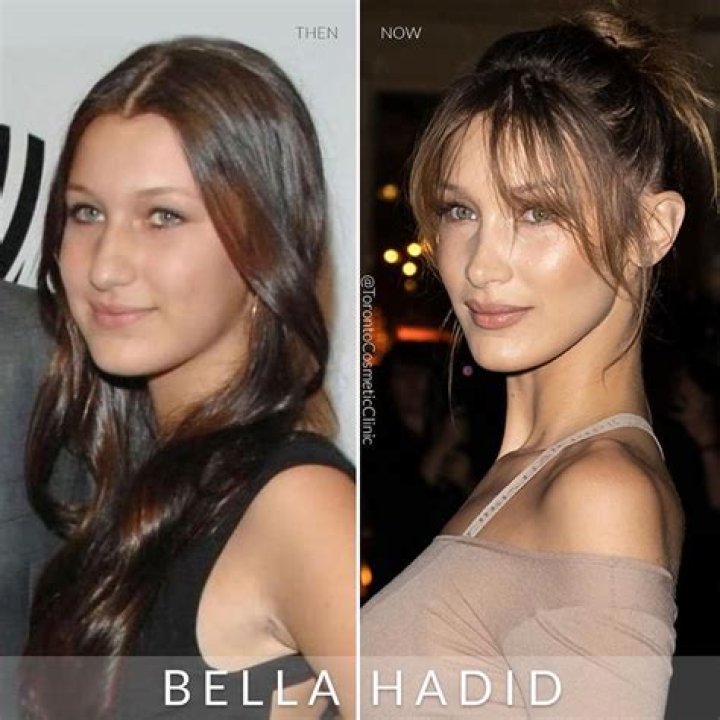 Has Bella Hadid Settled Her Federal Lawsuit Over Instagram Post? Find Out The Update Here
