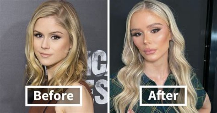 Has Katherine Heigl had plastic surgery? Actress 
