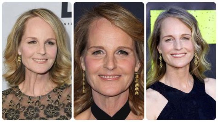 Helen Hunt’s Plastic Surgery Rumors Are Circulating the Internet