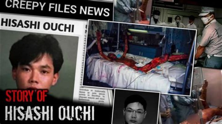 Hisashi Ouchi Photos Graphic: Understanding The Tragic Story Behind The Images