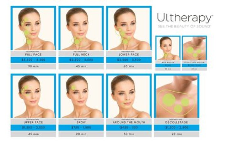 How many shots do you get from Ultherapy?