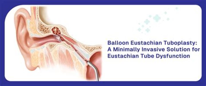 How to Clear a Eustachian Tube Blockage