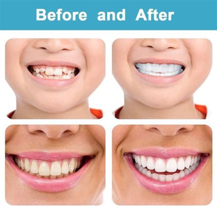Is Annie Murphy Wearing Fake Teeth? Beauty Secrets