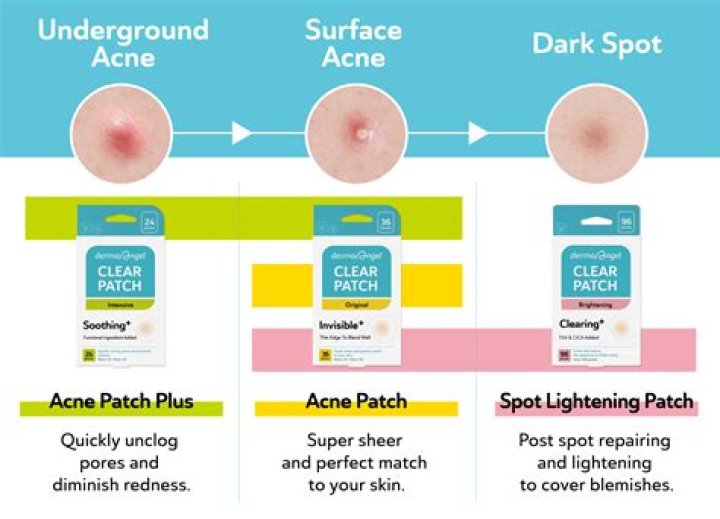 Is Exfoliation Good For Acne? According To The Experts, The Answer Isn't A Simple One