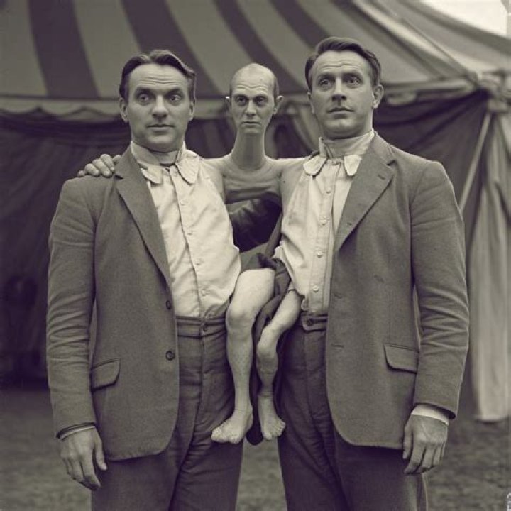 Jean Libbera: Anomaly, Physical Condition, Conjoined Twins, Family, Performances, Marriage, Wife, Children And Other Updates