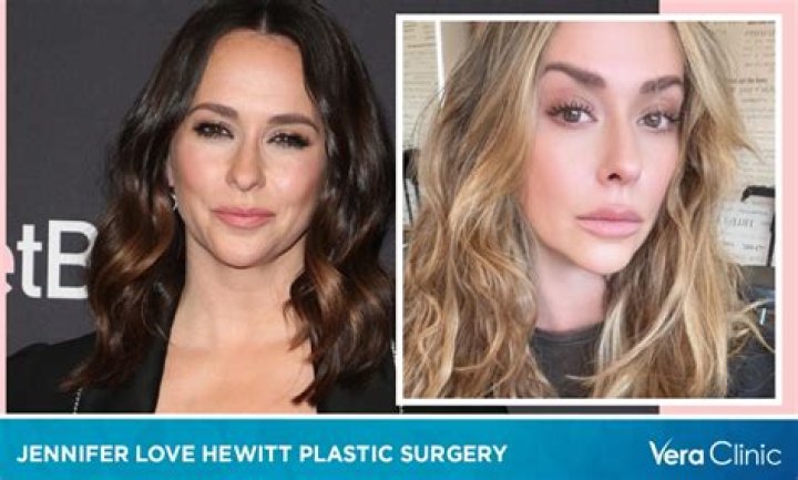Jennifer Love Hewitt Chirurgie: Transformation Capillaire et Rumeurs de ChirurgieDémenties!