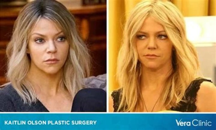 Kaitlin Armstrong Plastic Surgery: How She Tried to Escape Justice