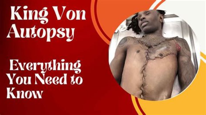 King Von Autopsy Pics: A Deep Dive Into The Legacy Of A Fallen Star