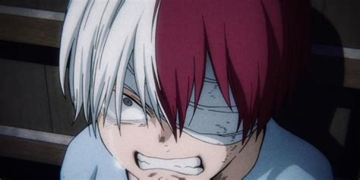 My Hero Academia Detail Shows Why Shoto Todoroki's Scar Is So Bad