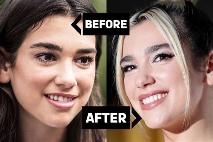 New: Selena Gomez Teeth : Before and After