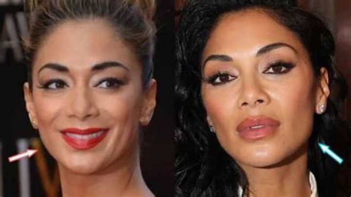 Nicole Scherzinger Before And After: The Pussycat Dolls Sparks Plastic Surgery Rumors