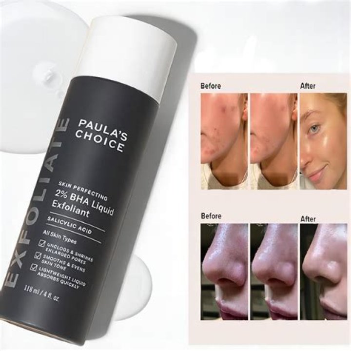 Paula's Choice £26 exfoliant hailed as a 'wonder' product for clearing up acne... and fans claim it works 'within 30 minutes'