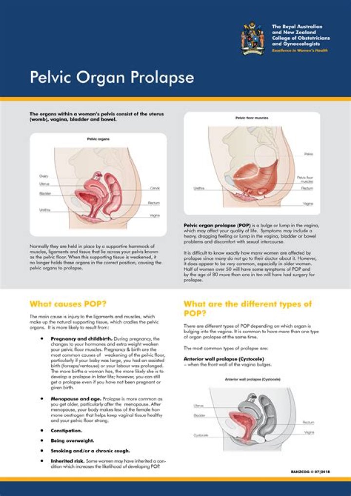 Pelvic Organ Prolapse Symptoms: Doctors Explain the Variations
