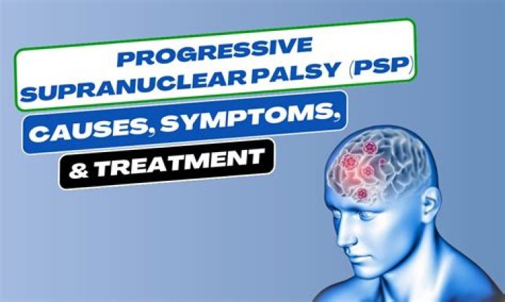 Population based mortality and quality of death certification in progressive supranuclear palsy (Steele-Richardson-Olszewski syndrome) - ePrints