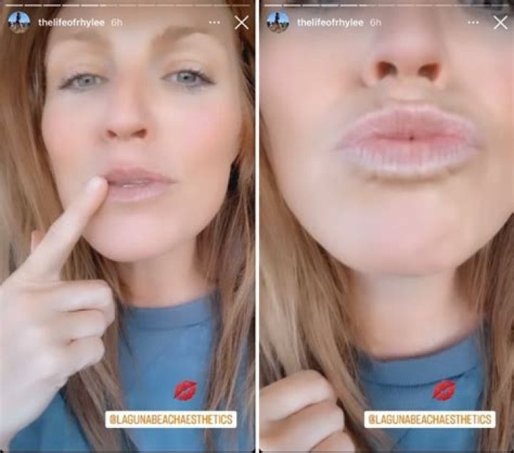 Rhylee Gerber opens up to Below Deck fans about transformative cosmetic procedure she had