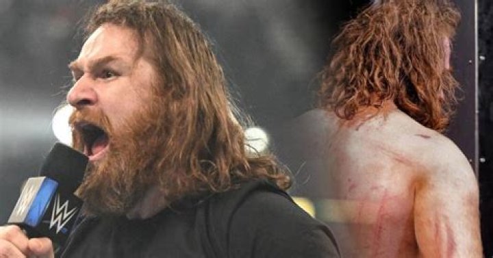 Sami Zayn Reveals Brutal Photo After WWE Elimination Chamber Match