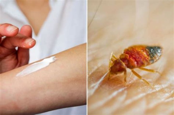 Severe shortage of bedbug bite treatment hits UK as pest expert warns ‘they’re ALREADY in your house’