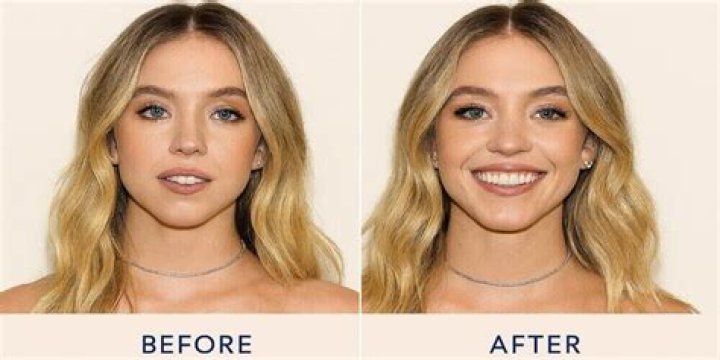 Sydney Sweeney’s Plastic Surgery: Fact or Fiction?