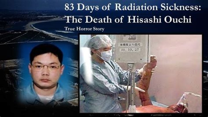 Understanding Hisashi Ouchi: The Tragic Story Of Radiation Exposure