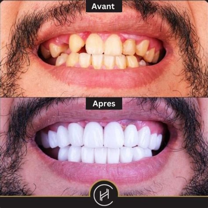Vitaa Chirurgie: Avant et Après – Les Révélations Choc