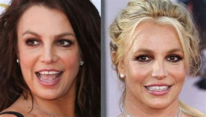 What happened to Britney Spears Teeth? Unveiling the Story Behind Her Teeth Transformation