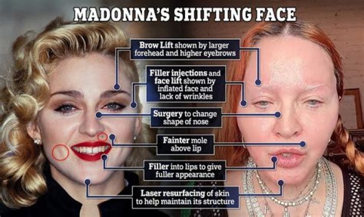 What happened to Madonna's face?