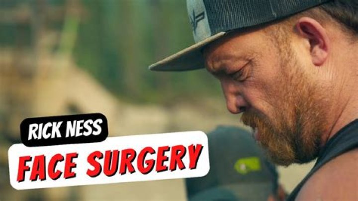 What happened to Rick Ness nose? Unraveling the truth 