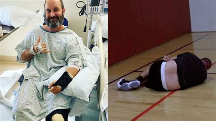 What Happened to Tom Segura? Comedian's leg injury explained