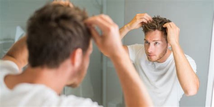 Why Men Go Bald and What to Do About It