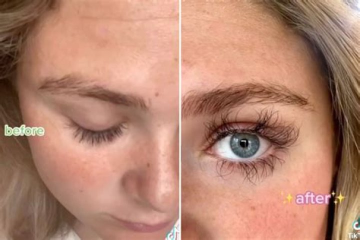 Woman forced to trim her EYELASHES after growth serum makes them look like extra-long spider legs